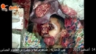 Scenes of the dead, dying,  injured Muslim Brotherhood supporters in Adaweya.